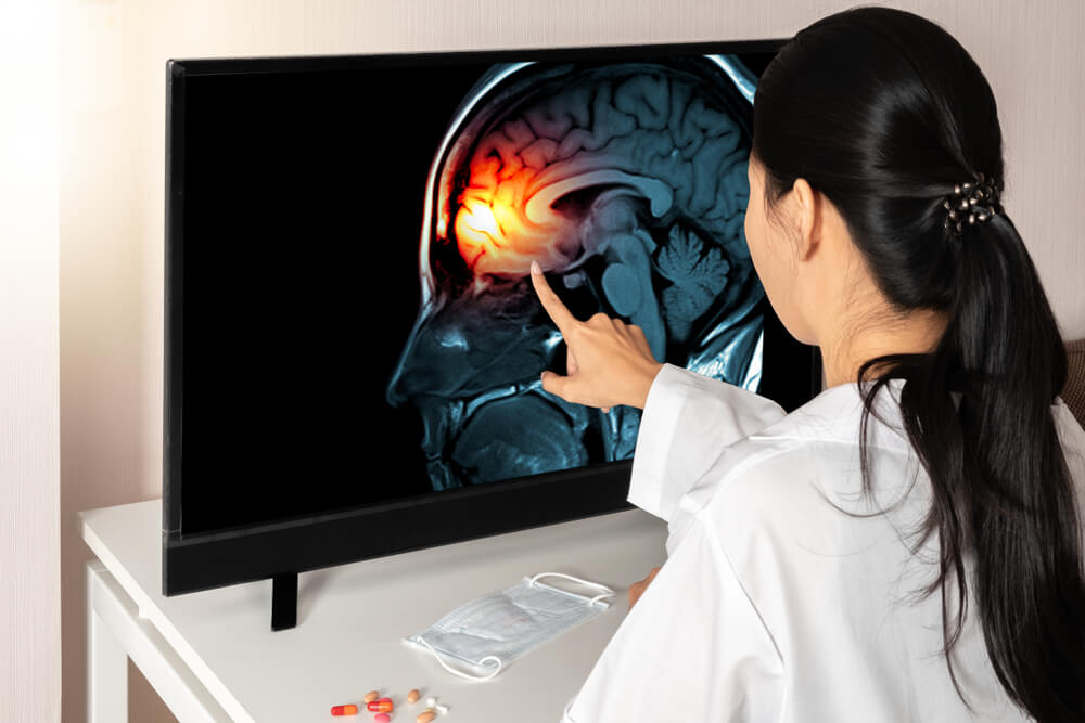 woman looking at brain scan