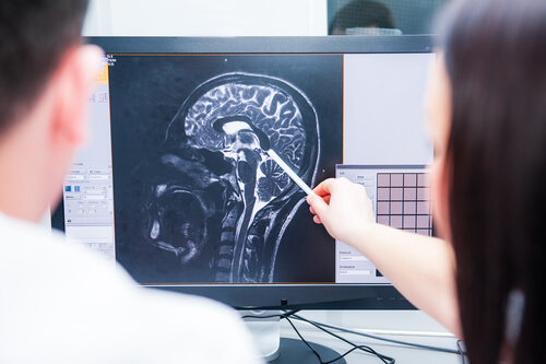 doctors examining x-ray of brain