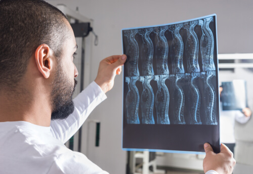 doctor looking at spinal cord xray
