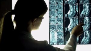 Doctor chiropractor doctor looking at spine Xray