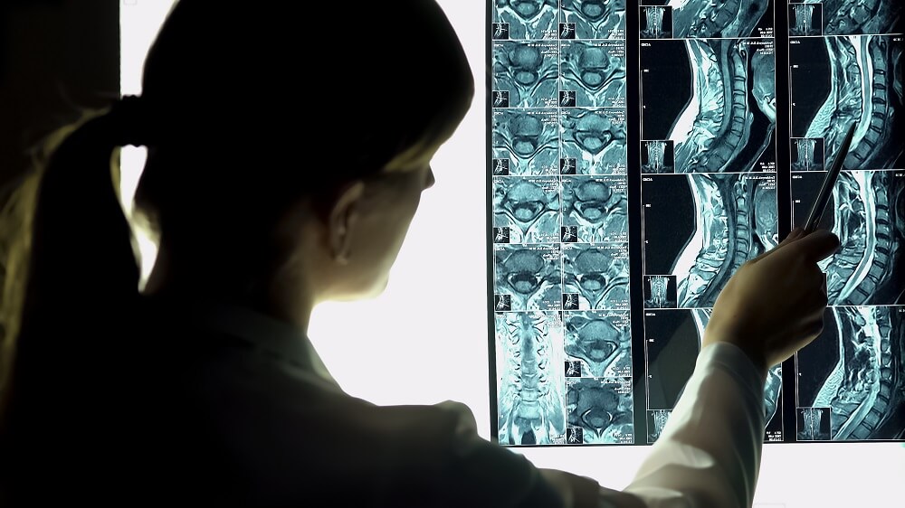 Doctor chiropractor doctor looking at spine Xray