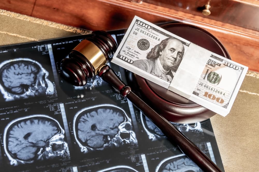 A composite image combining legal and medical elements, featuring brain MRI scans, a judge’s gavel, and US currency symbolizing brain injury claims and compensation.