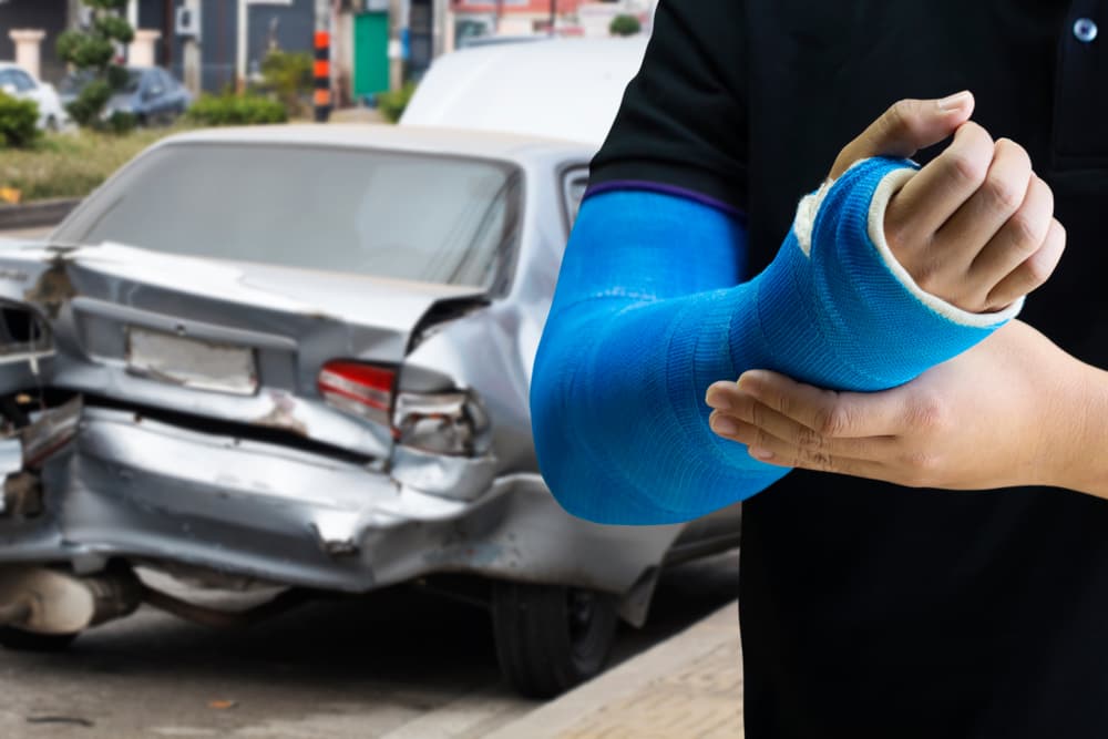 Close-up of a man with a blue bandage on his hand, symbolizing an arm injury after a car accident.